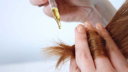 hair loss treatmend-درمان موخوره